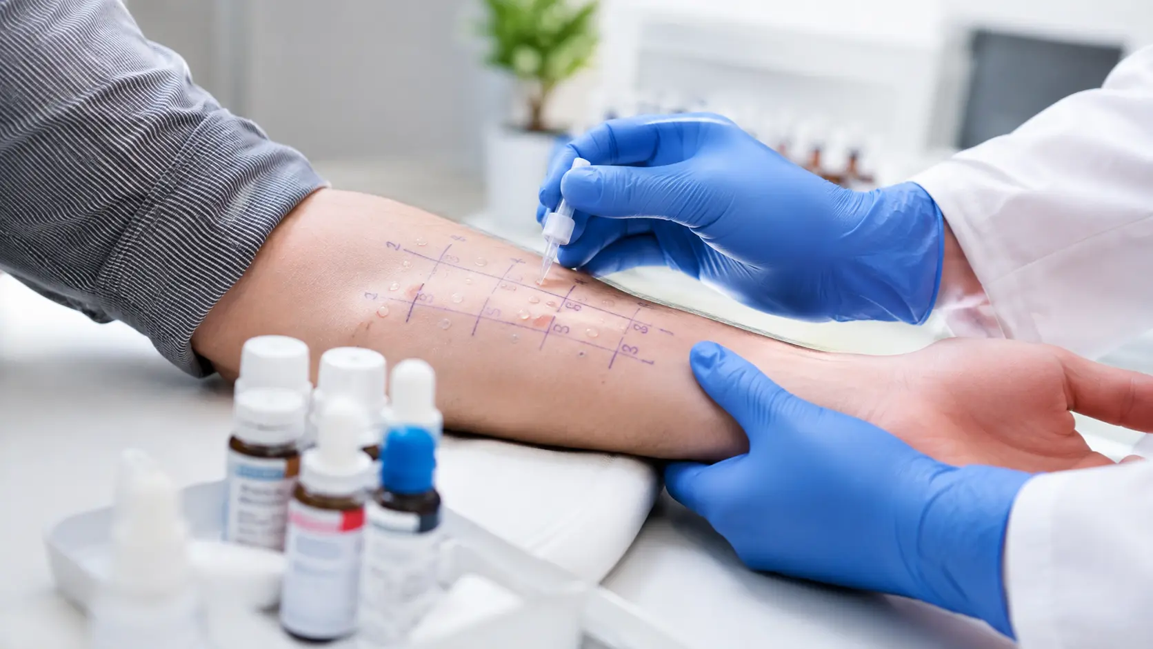 Cat Allergy Testing: Skin Prick vs. Blood Tests & Diagnosis